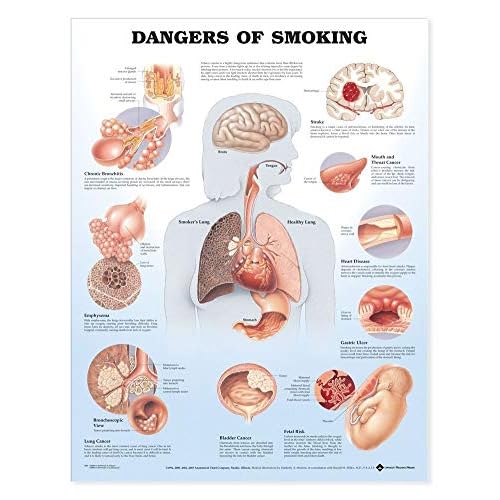Dangers of Smoking Anatomical Chart